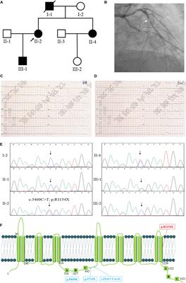 A Novel Nonsense Mutation of ABCA8 in a Han-Chinese Family With ASCVD Leads to the Reduction of HDL-c Levels